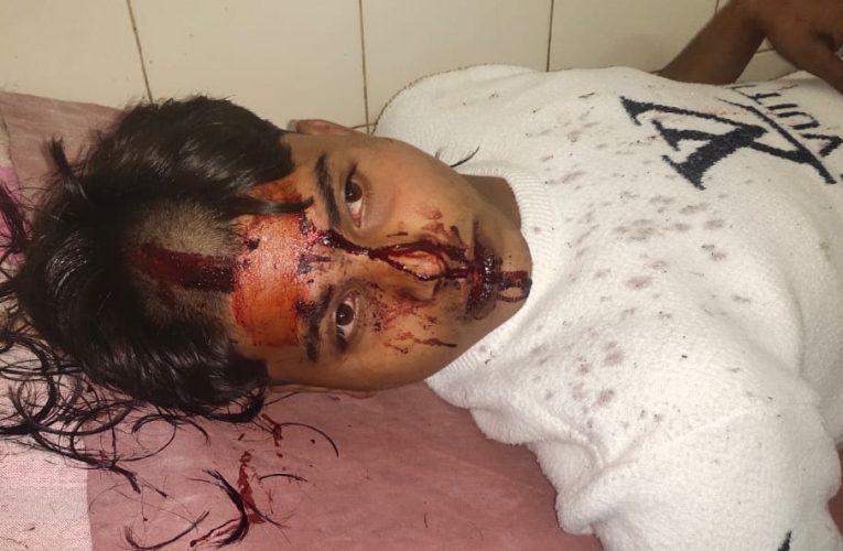 बर्थ डे पार्टी से घर वापस आ रहे युवक को घेर कर पीटा हालत गंभीर।