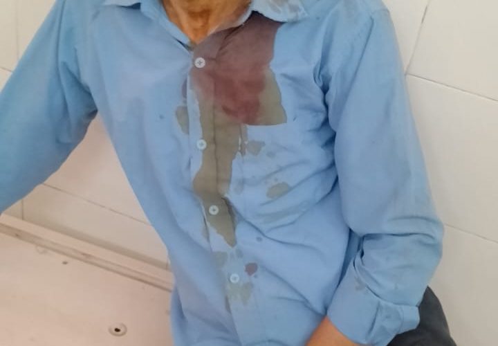 रास्ते से टैक्टर ट्राली हटाने को कहने पर मनबढ़ो ने एक परिवार पर किया हमला चार घायल।