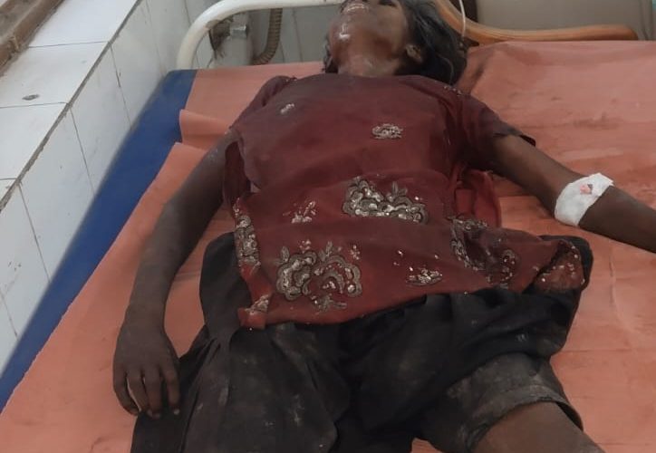 चोपन में अज्ञात महिला की मौत, पुलिस पहचान में जुटी.