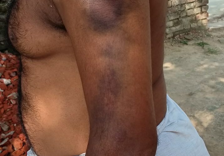 जमीन बेचने पर विवाद, सेमरहवा बाजार में विकलांग राममूरत से मारपीट, मोबाइल तोड़ा